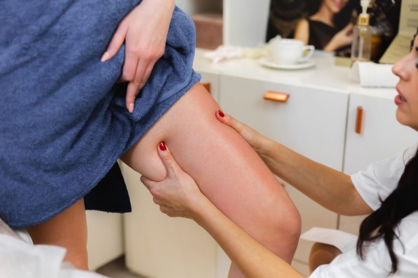 La importancia de un diagnóstico de varices preciso y precoz